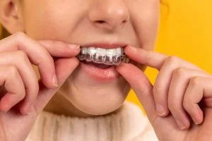 Related Dental Injuries: Mouthguards and More